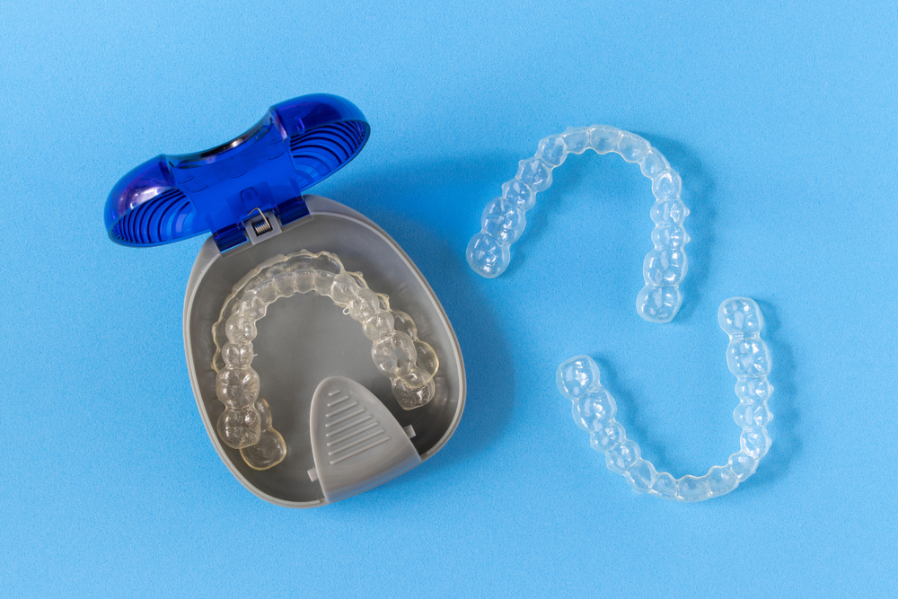 Invisalign,Braces,Or,Invisible,Retainer,On,Blue,Background