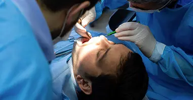 root canal