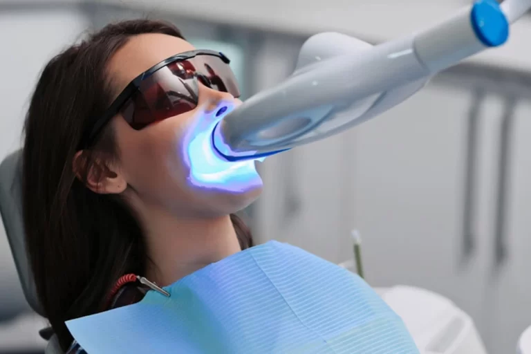 How to Keep Your Teeth White After Professional Teeth Whitening